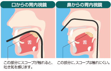 内視鏡図解